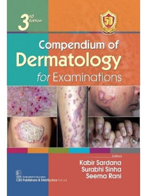 Compendium of Dermatology for Examinations 3rd/2023