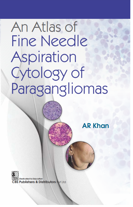 An Atlas Of Fine Needle Aspiration Cytology And Paraganglimas (Hb 2024)