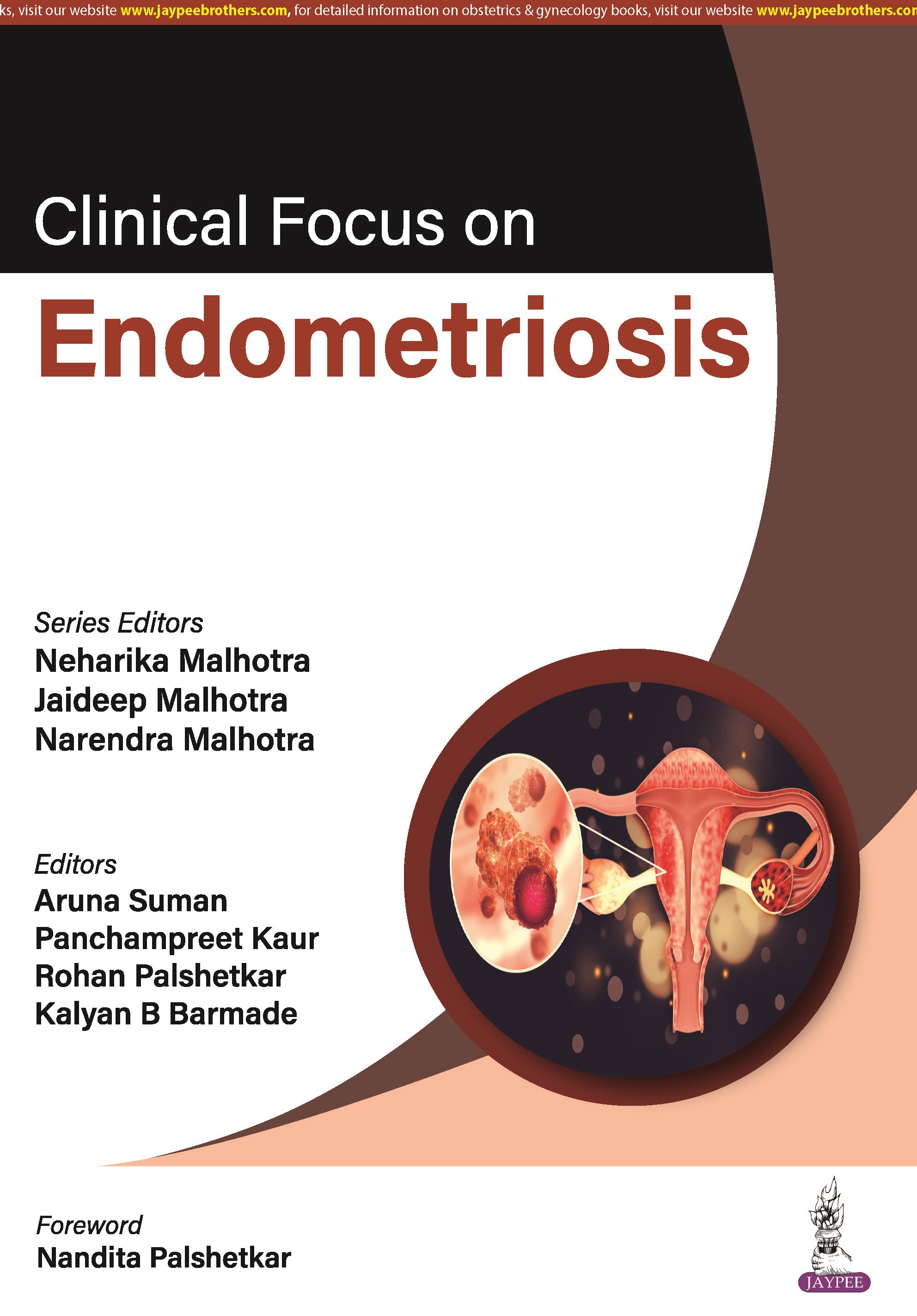 Clinical Focus on Endometriosis 1st 2024