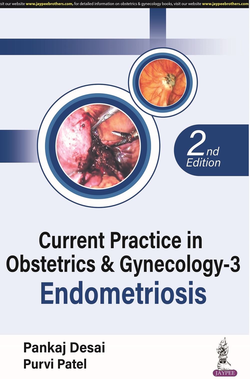 Current Practice in Obstetrics & Gynecology-3 Endometriosis