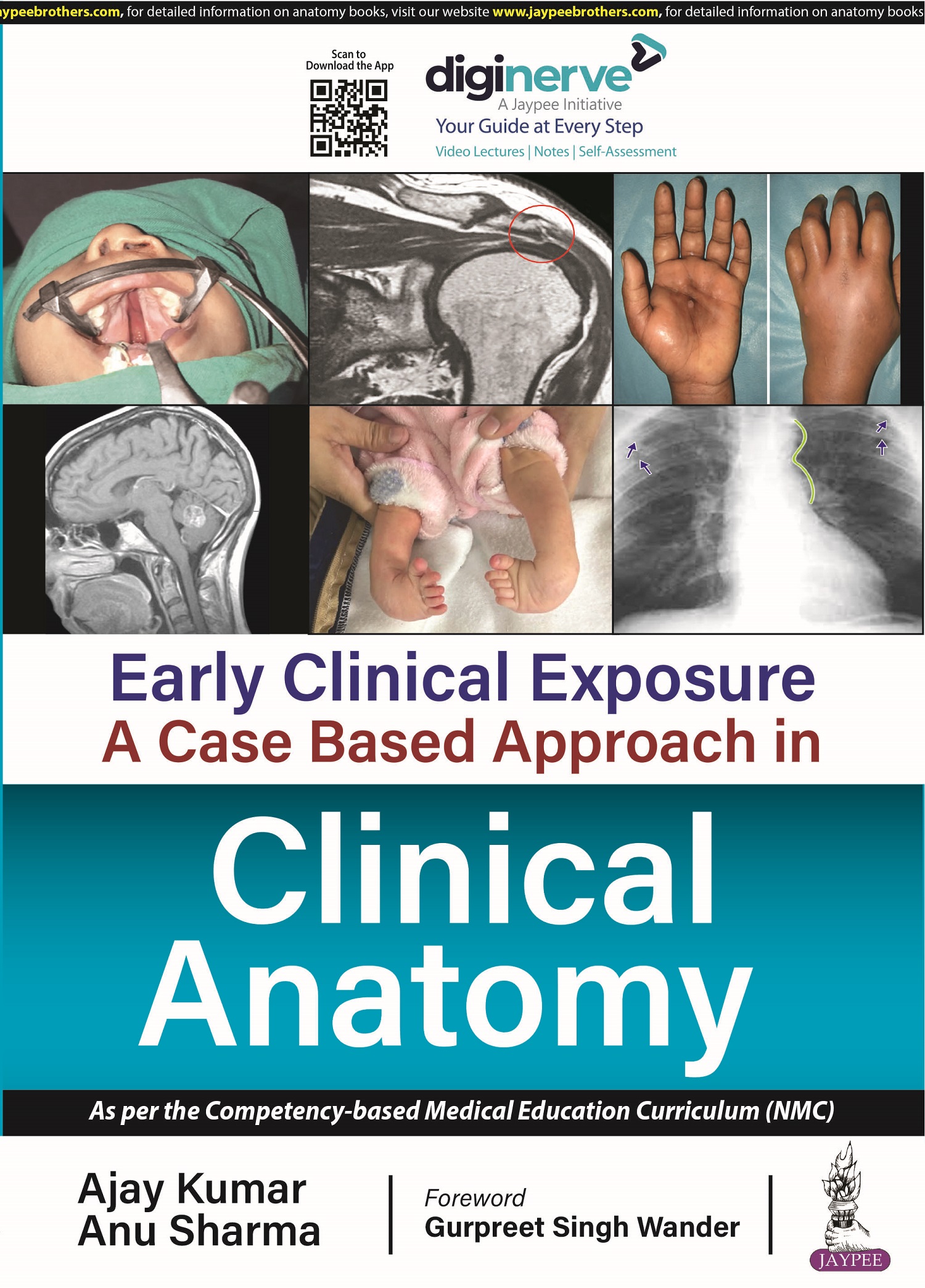 Early Clinical Exposure: A Case Based Approach in Clinical Anatomy