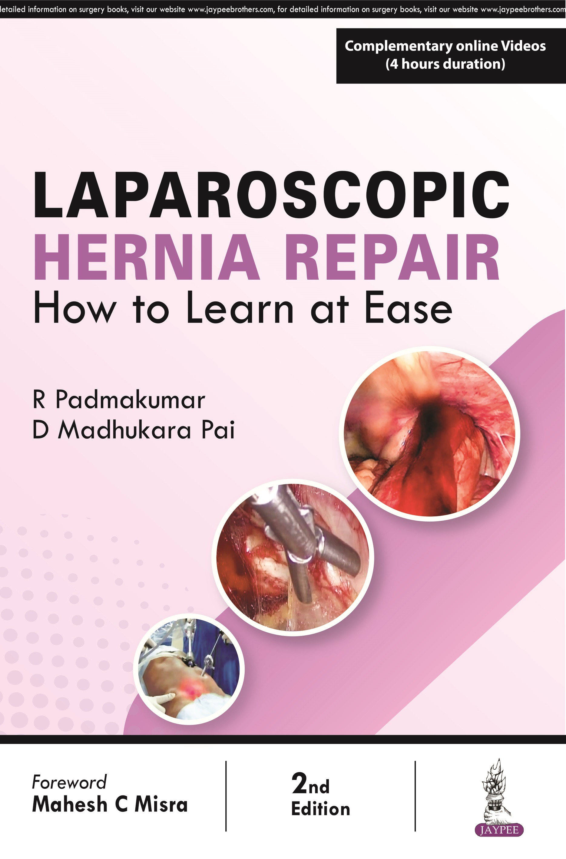 Laparoscopic Hernia Repair: How To Learn At Ease