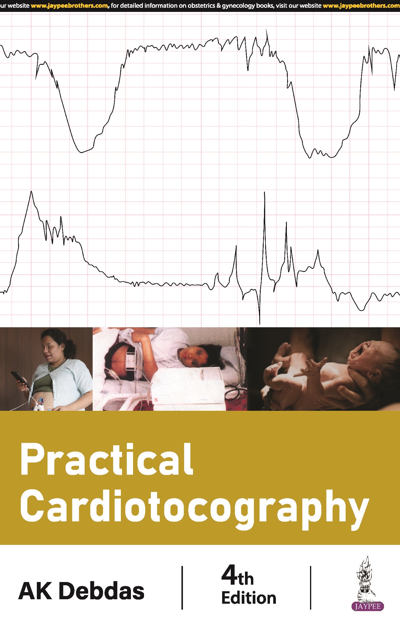 Practical Cardiotocography 4th 2024