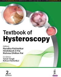 Textbook of Hysteroscopy 2nd Edition 2024