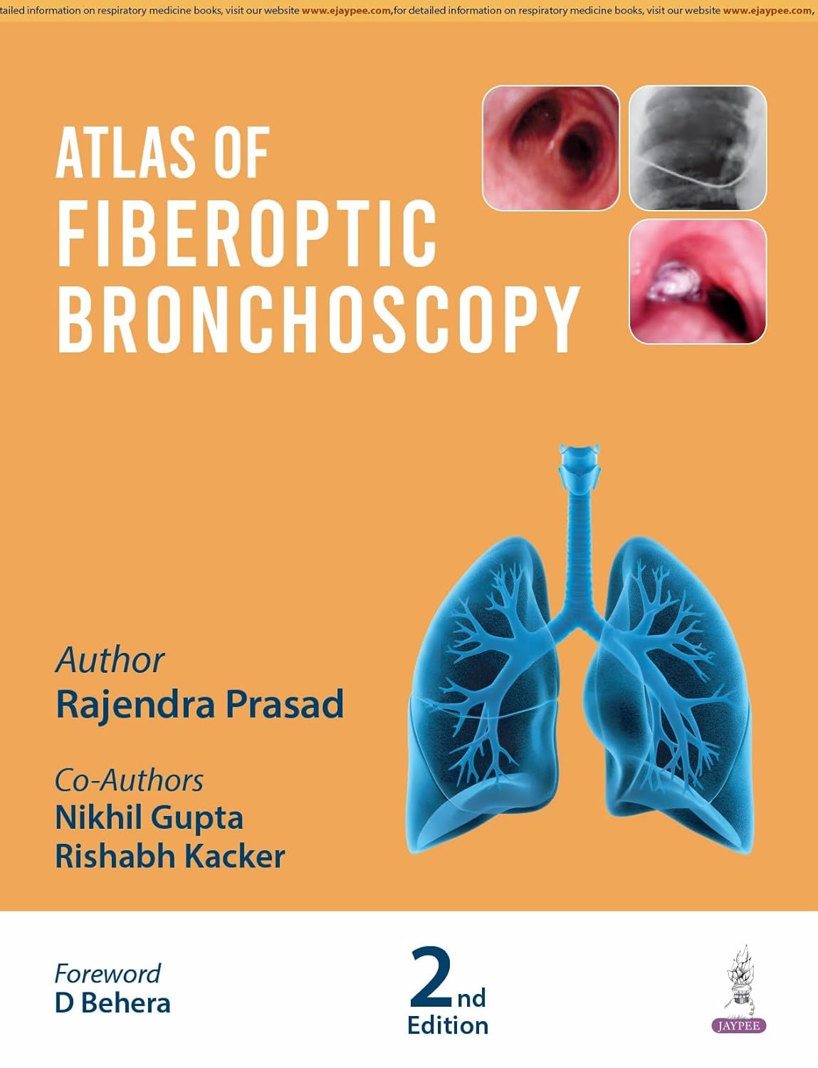 Atlas Of Fiberoptic Bronchoscopy
