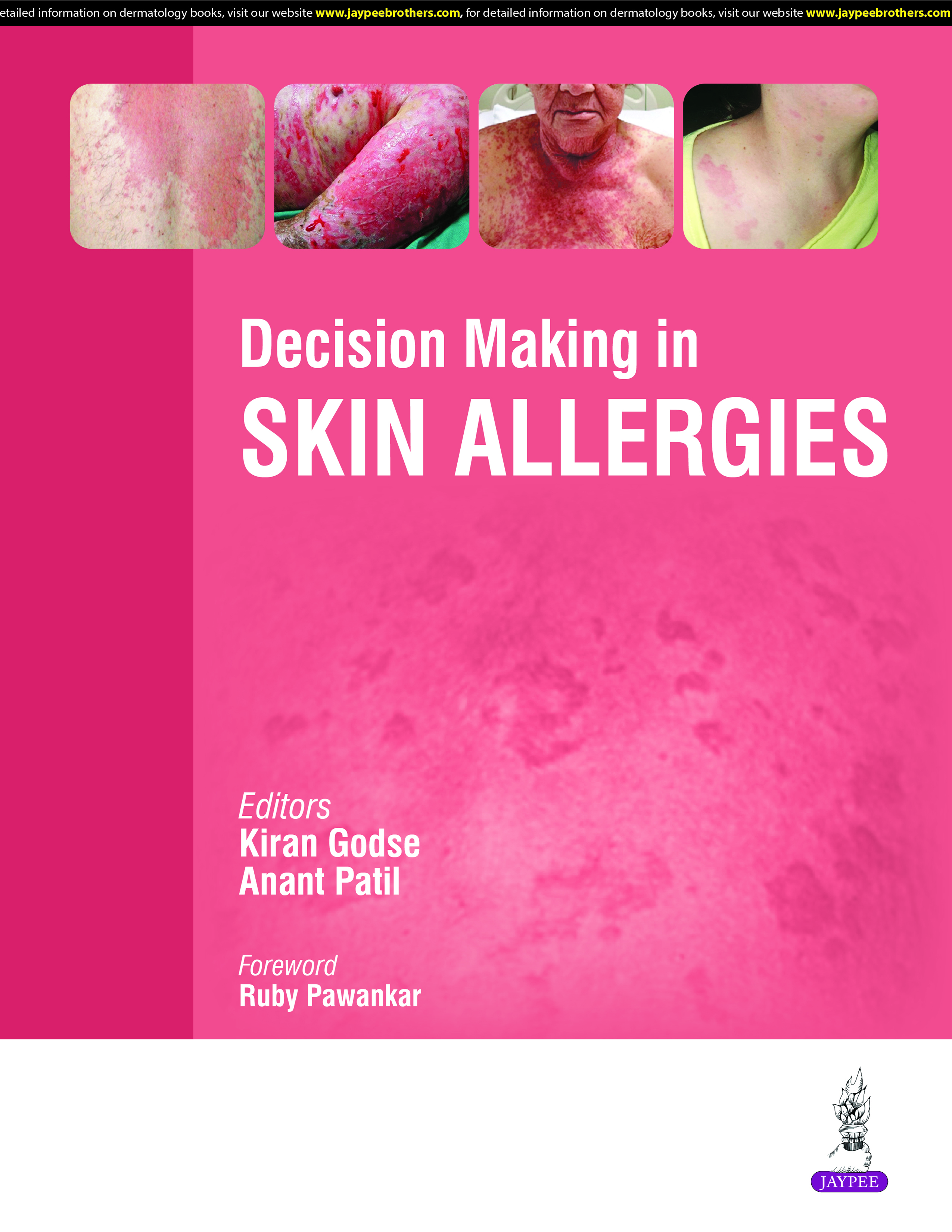 Decision Making In Skin Allergies