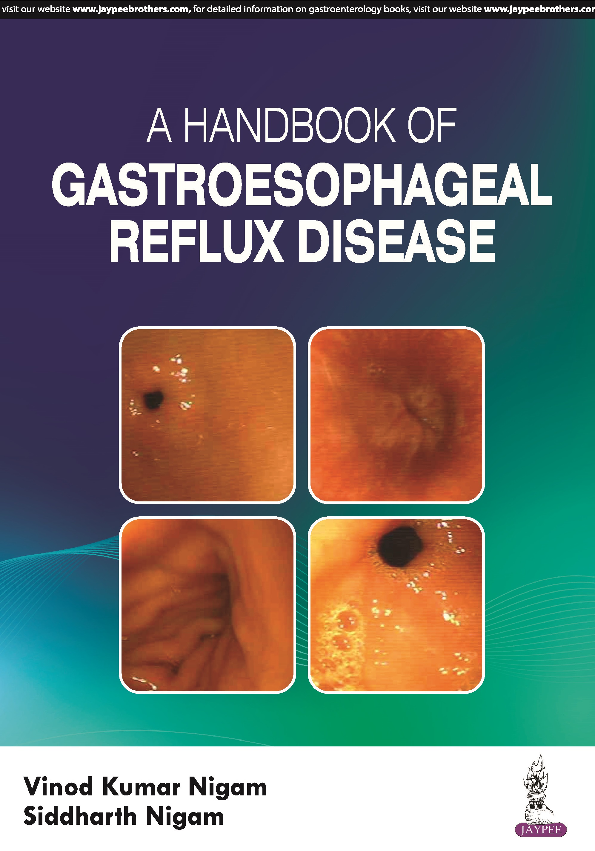 A Handbook of Gastroesophageal Reflux Disease 1st 2024