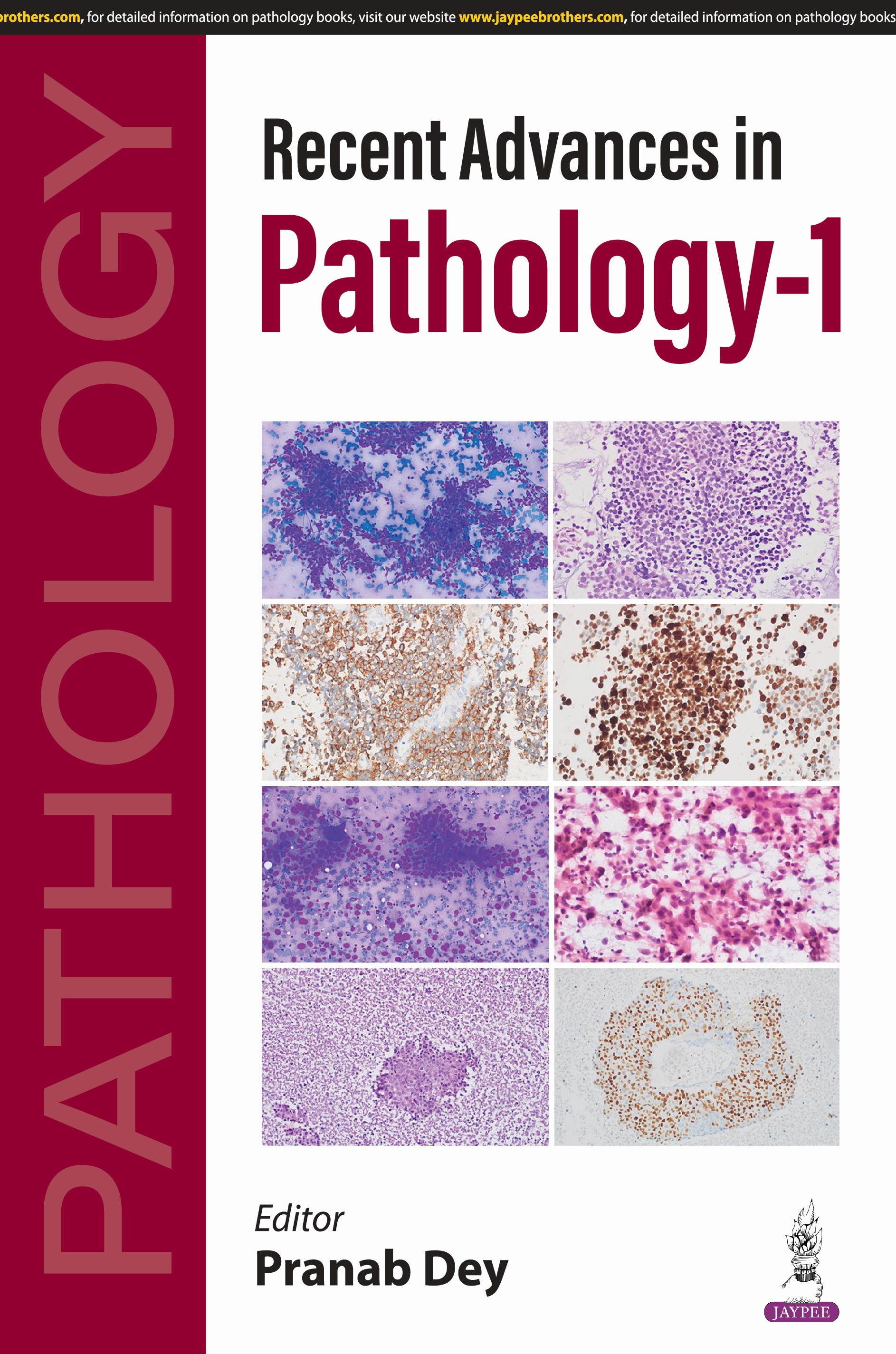 Recent Advances in Pathology-1