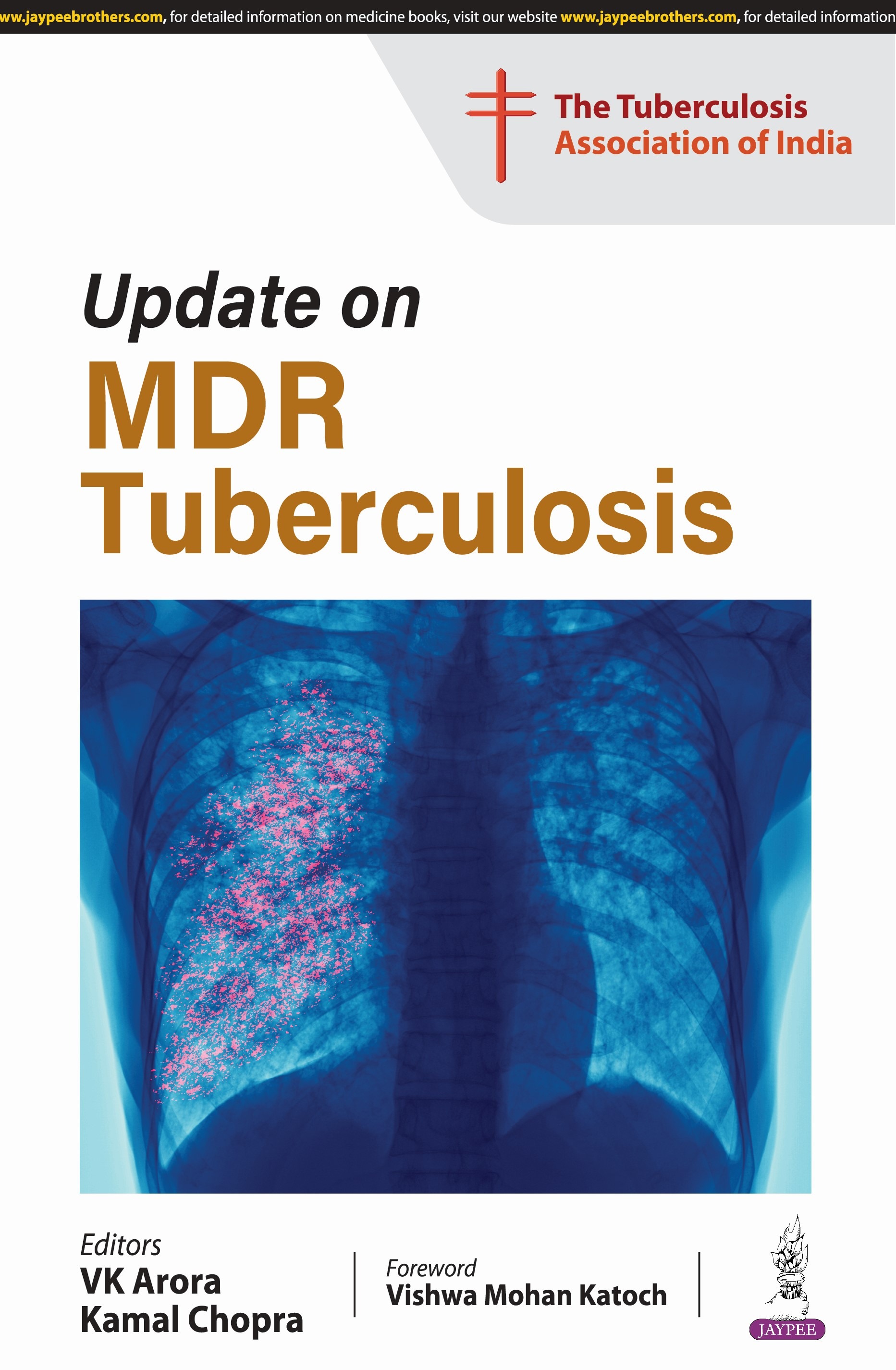 Update On Mdr Tuberculosis