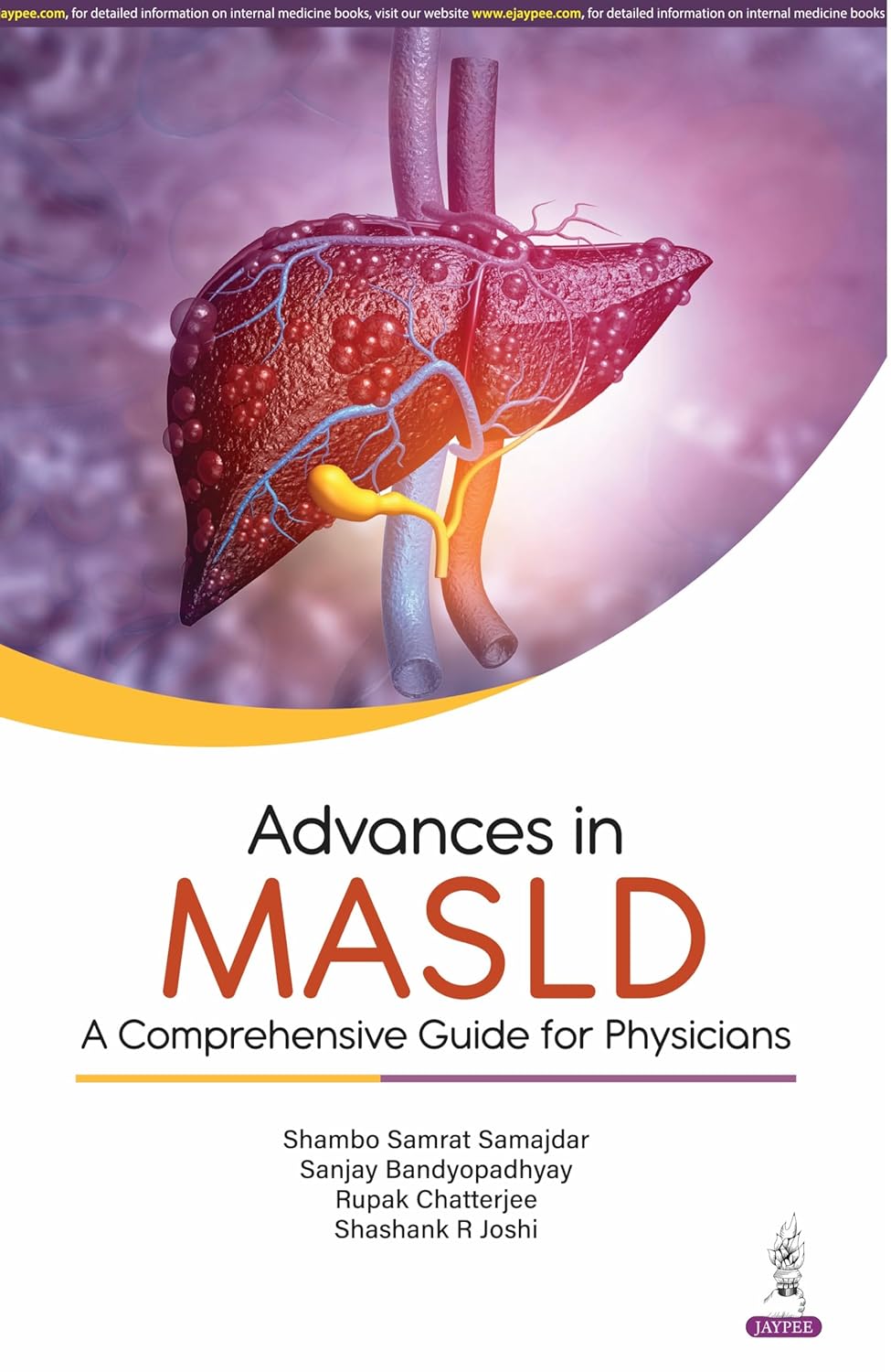 Advances In Masld : A Comprehensive Guide For Physicians
