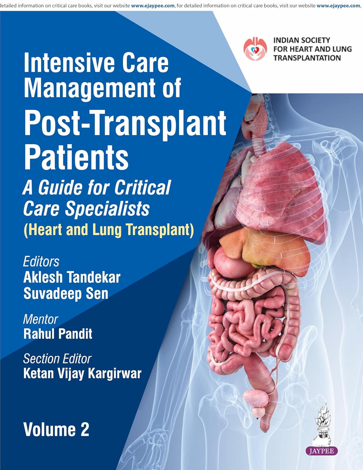 Intensive Care Management Of Post-Transplant Patients: A Guide For Critical Care Specialists Vol.2
