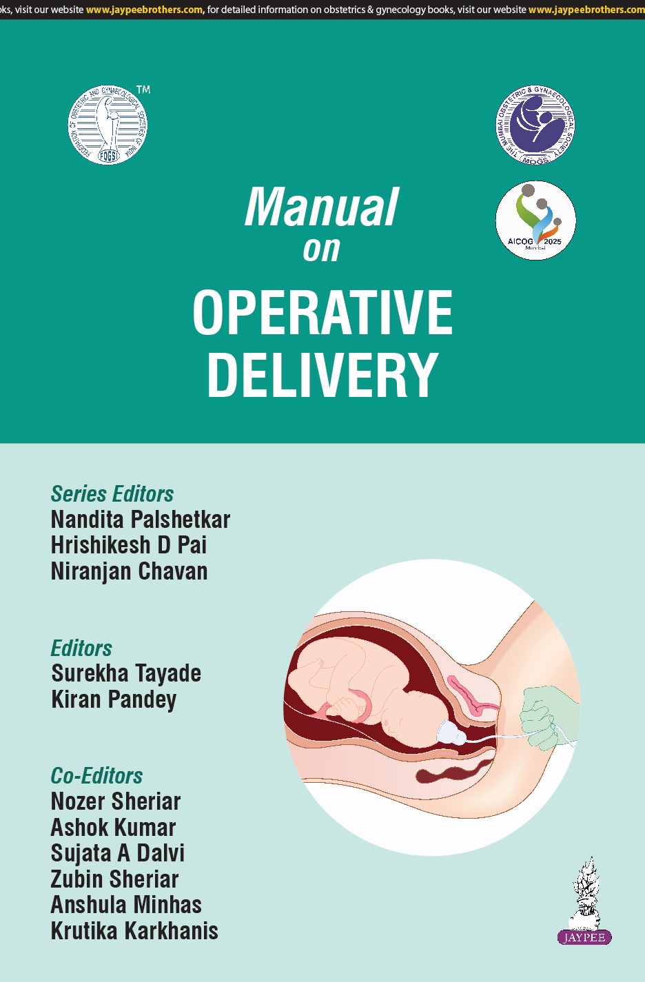 Manual On Operative Delivery (Aicog 2025)