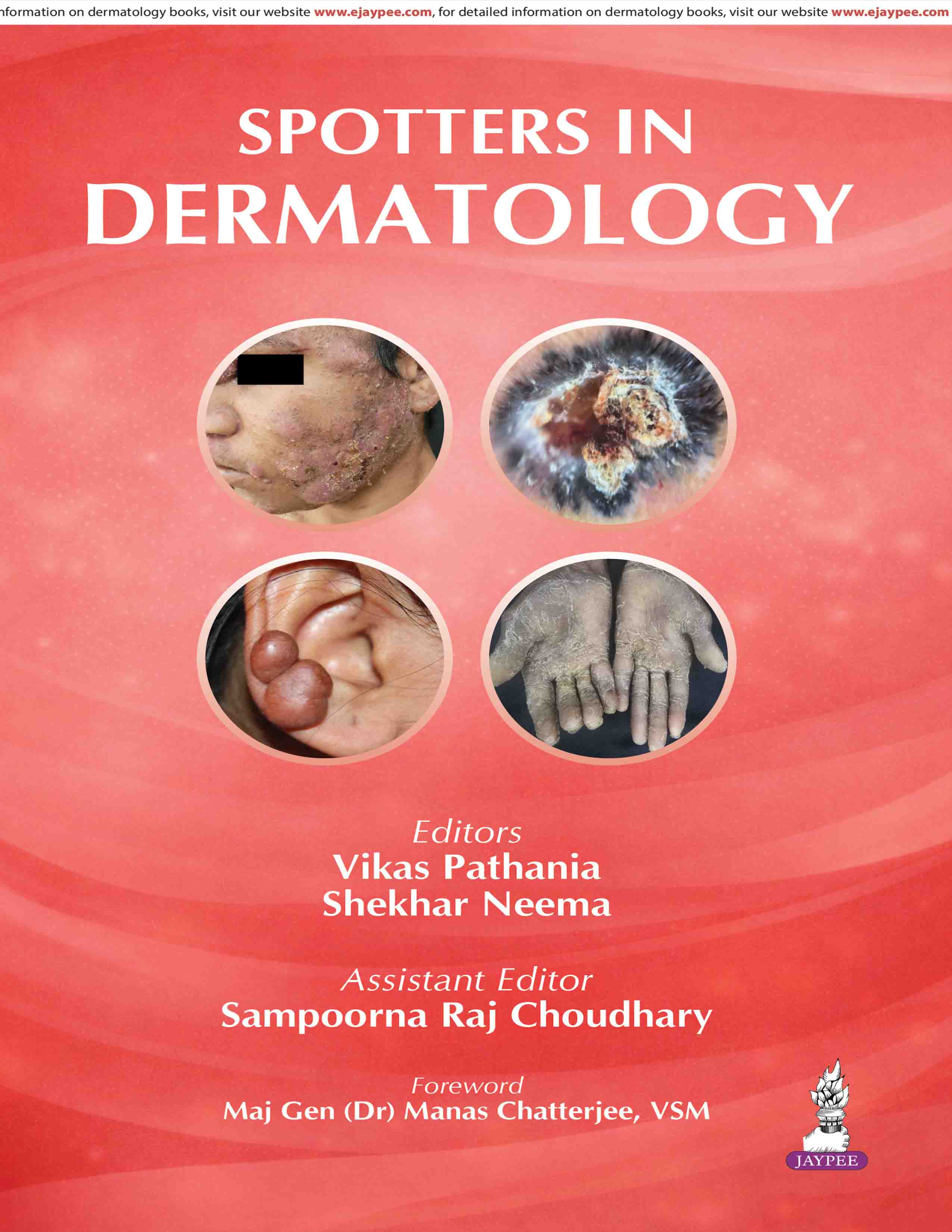Spotters In Dermatology