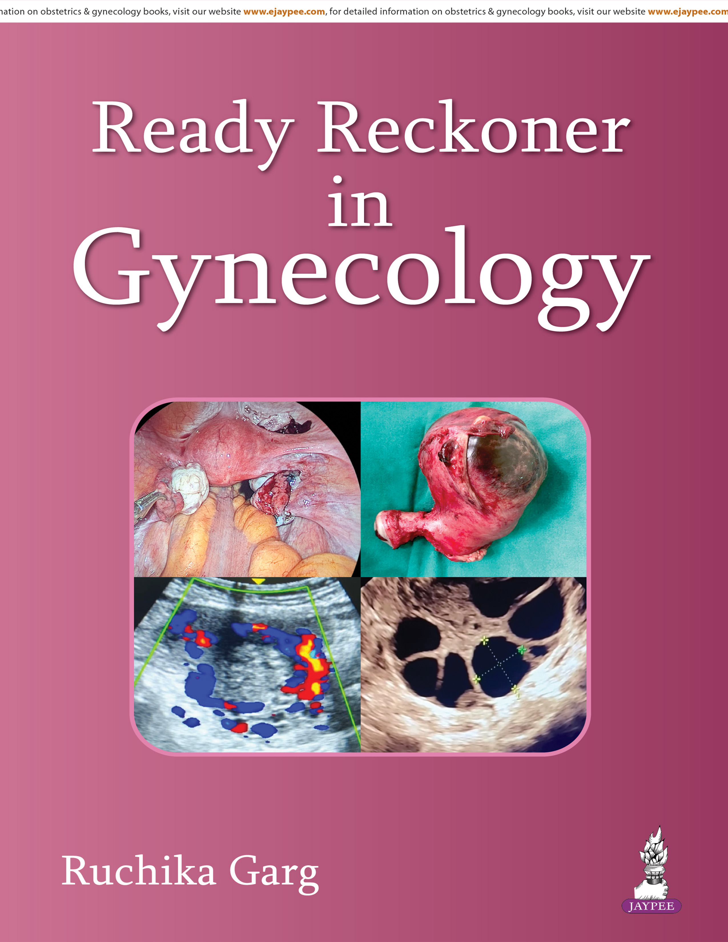 Ready Reckoner In Gynecology