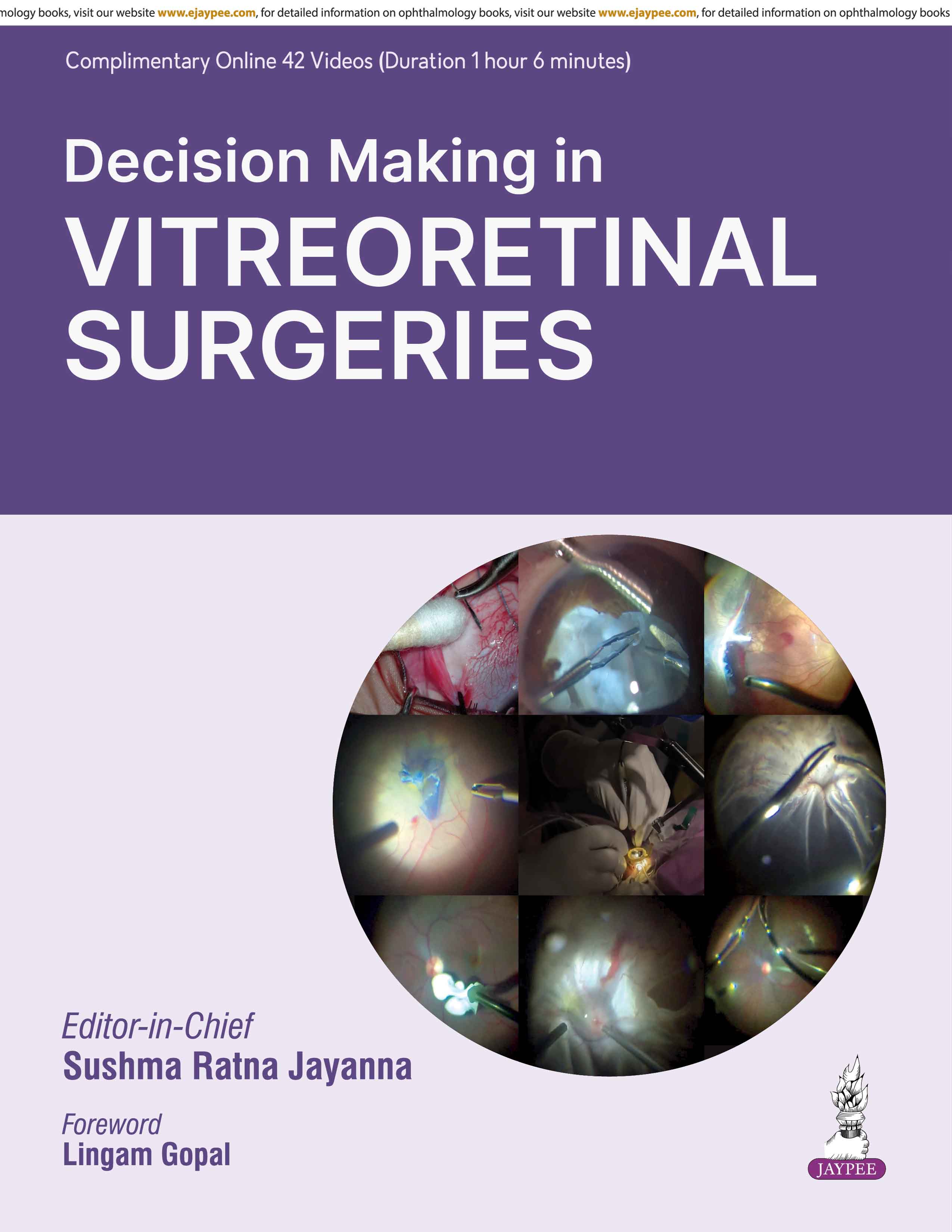 Decision Making In Vitreoretinal Surgeries