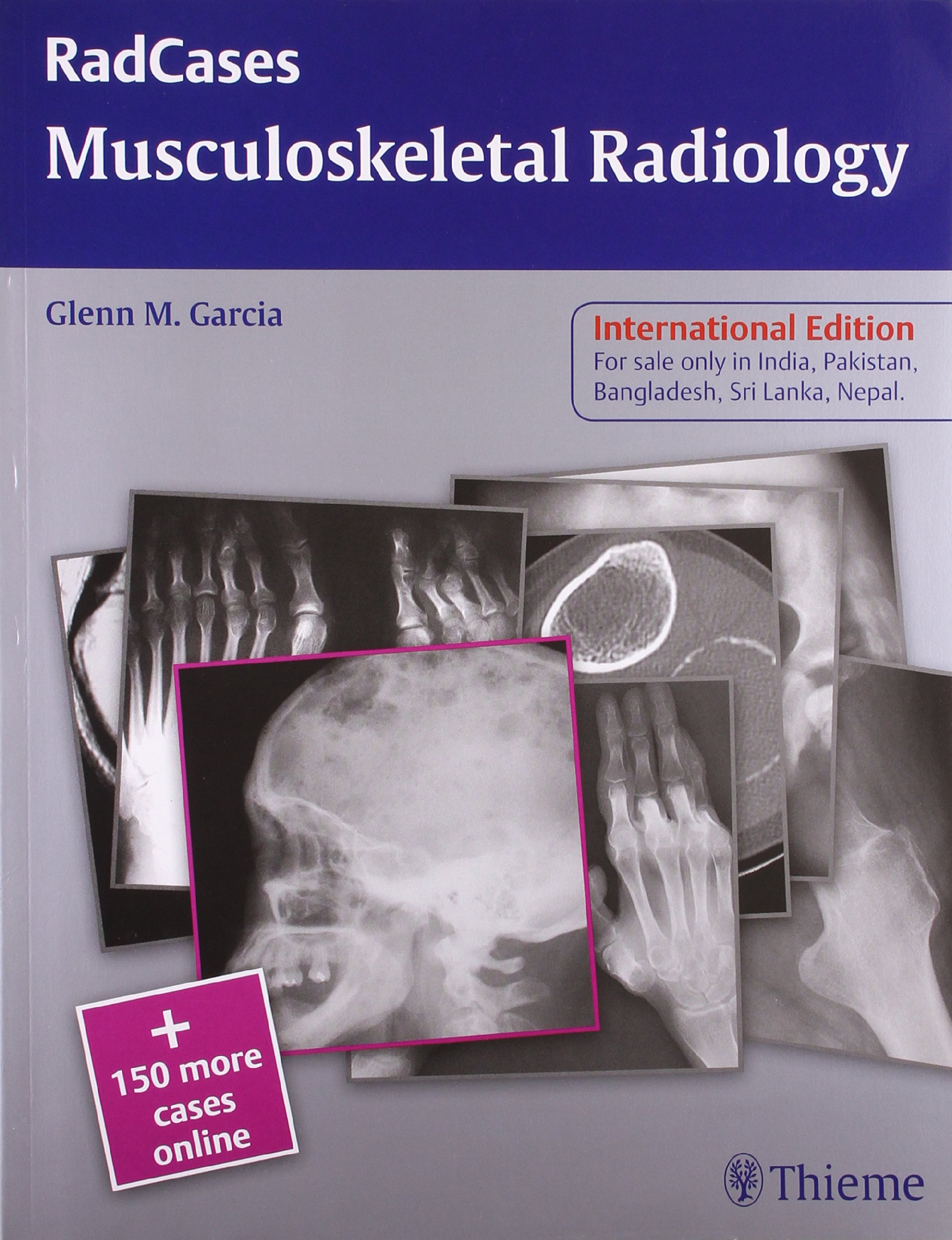 Musculoskeletal Radiology: 1/E Radcases (Indian Reprint)