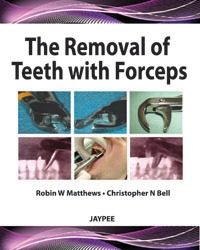 The Removal Of Teeth With Forceps