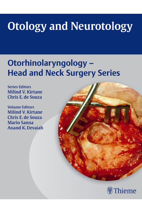 Otology and Neurotology Otolaryngology - Head and 