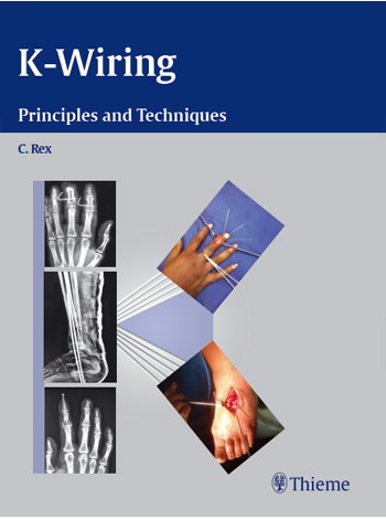 K-Wiring: Principles And Techniques 1/E