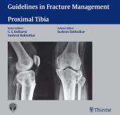 Guidelines in Fracture Management Proximal Tibia 