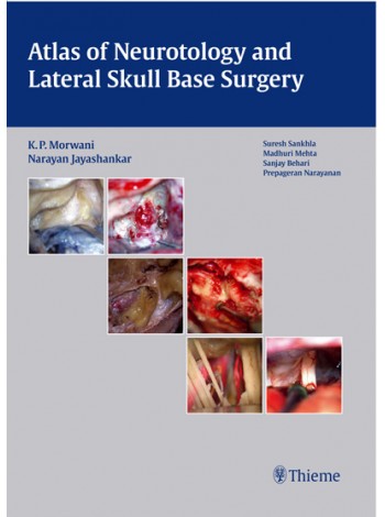 Atlas Of Neurotology And Lateral Skull Base Surgery