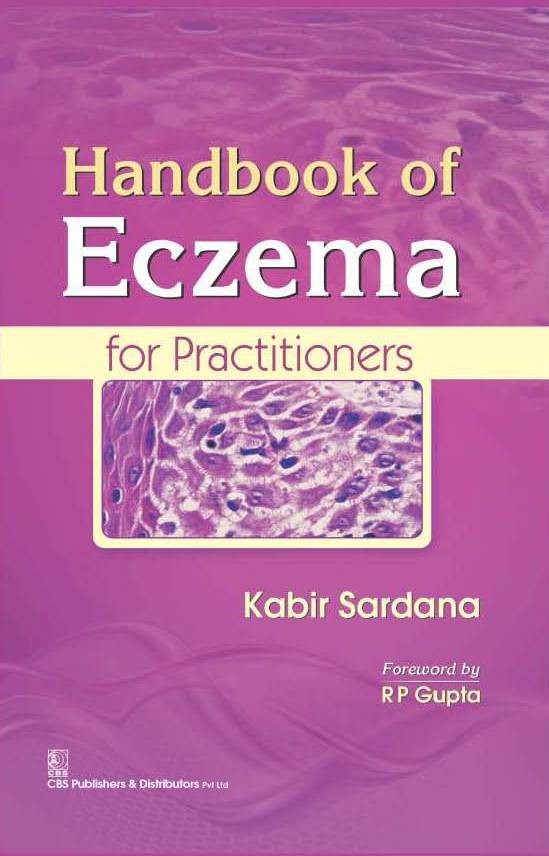 Handbook Of Eczema For Practitioners (Hb 2017)