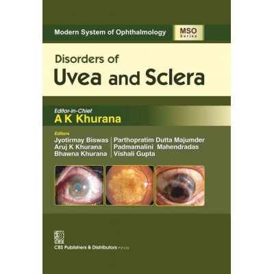 Modern System Of Ophthalmology (Mso) Series Disorders Of Uvea And Sclera