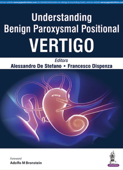 Understanding Benign Paroxysmal Positional Vertigo