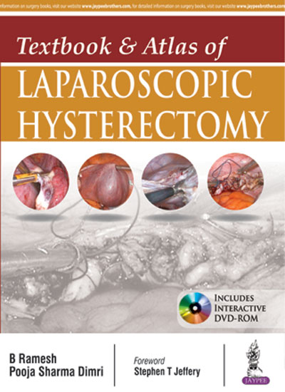 Textbook & Atlas Of Laparoscopic Hysterectomy