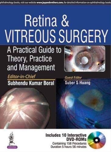 Retina & Vitreous Surgery A Practical Guide To Theory, Practice And Management With 10 Dvd-Roms