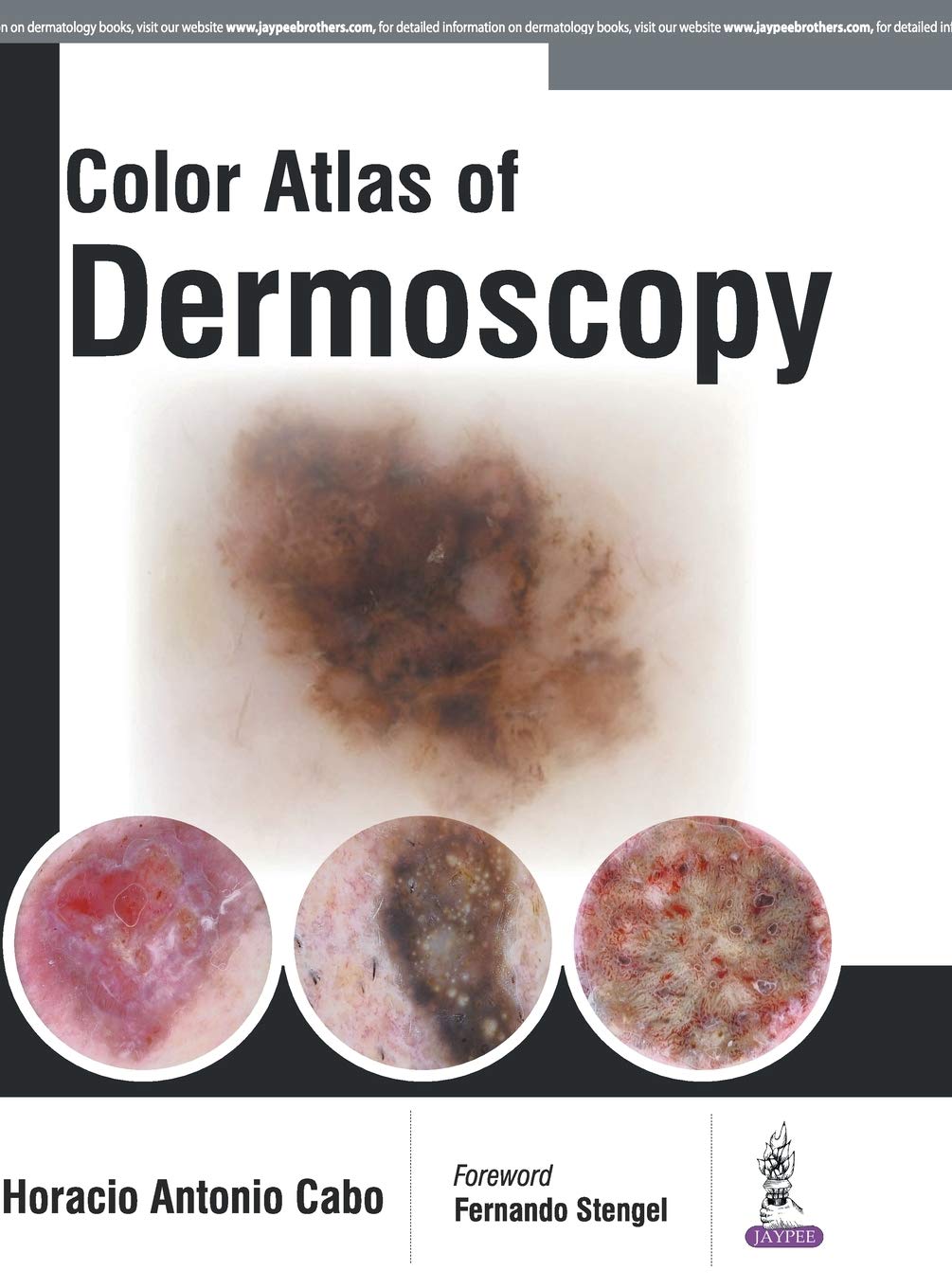 Color Atlas Of Dermoscopy