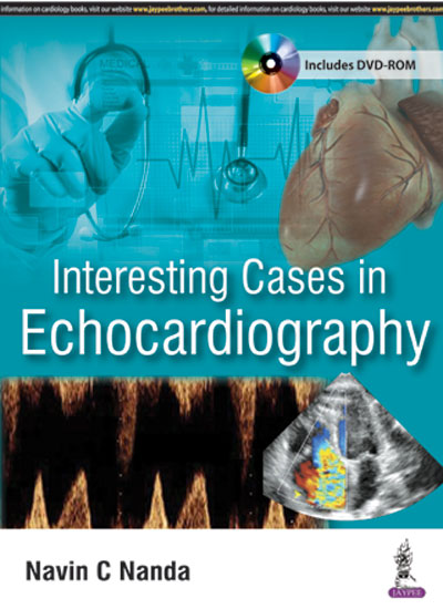 Interesting Cases In Echocardiography Includes Dvd-Rom