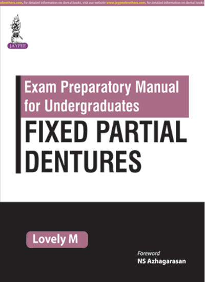 Exam Preparatory Manaul For Undergraduates Fixed Partial Dentures