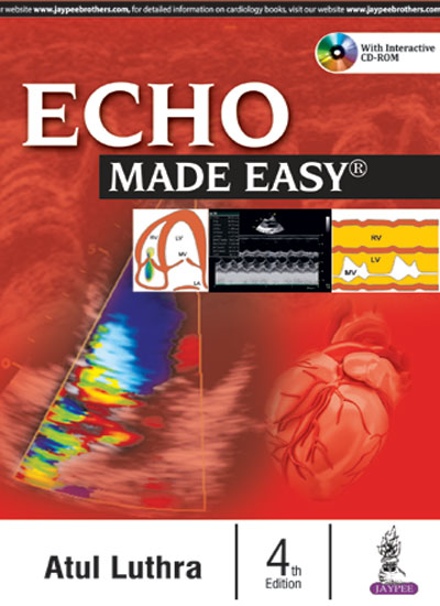 Echo Made Easy With Cd-Rom