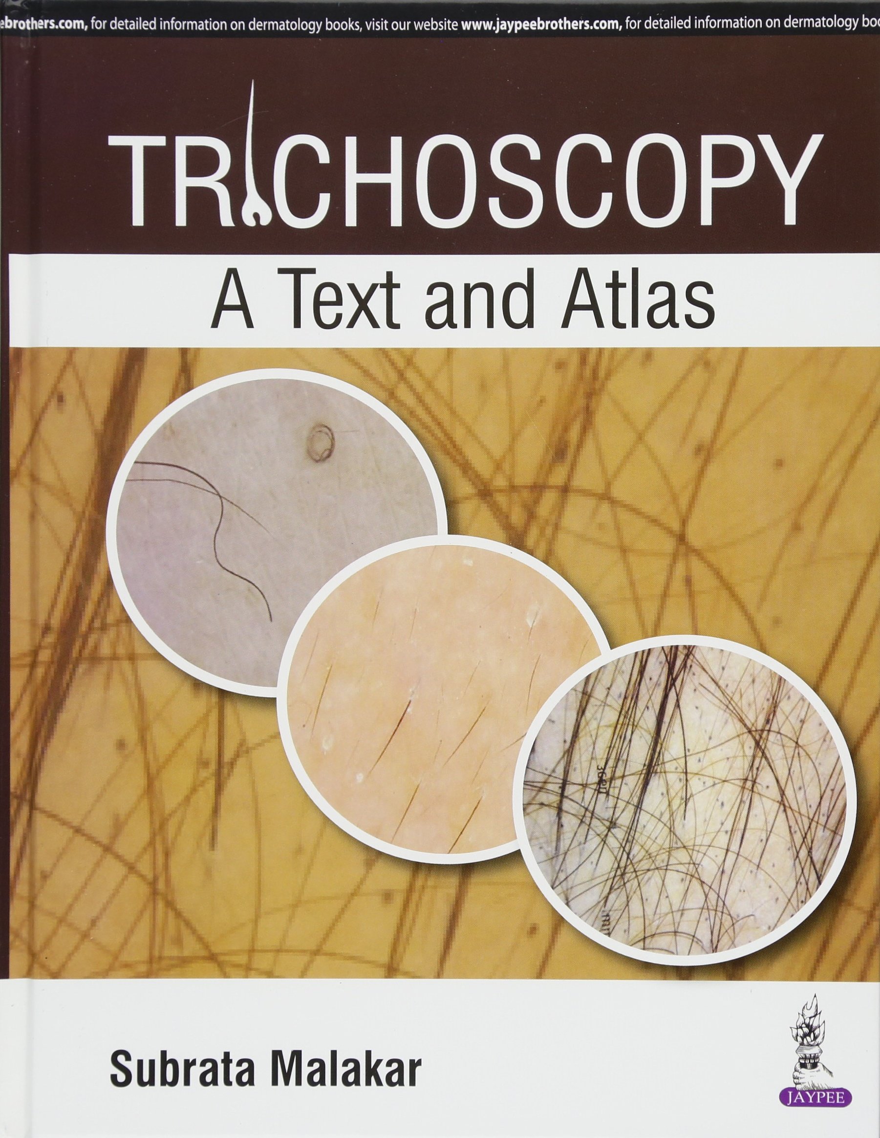 Trichoscopy: A Text And Atlas