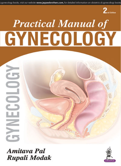 Practical Manual Of Gynecology