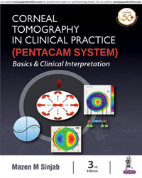 Corneal Tomography In Clinical Practice (Pentacam System): Basics And Clinical Interpretation