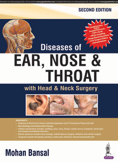 Diseases Of Ear, Nose And Throat