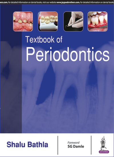 Textbook Of Periodontics(OLD EDITION)
