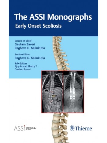 The ASSI Monographs: Early Onset Scoliosis: 1/e