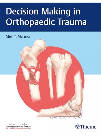 Decision Making in Orthopaedic Trauma: 1/e