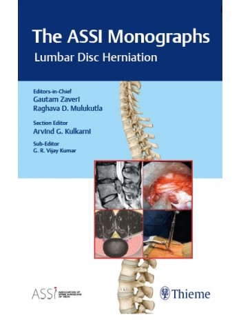 The ASSI Monographs: Lumbar Disc Herniation: 1/e