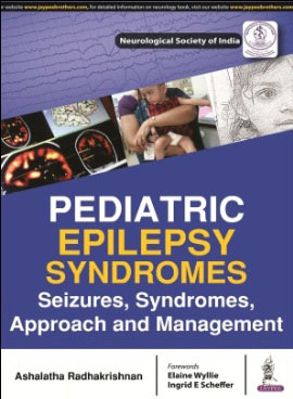 Pediatric Epilepsy Syndromes Seizures, Syndromes, Approach And Management