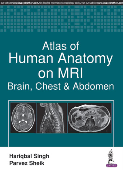 Atlas Of Human Anatomy On Mri:Brain, Chest & Abdomen