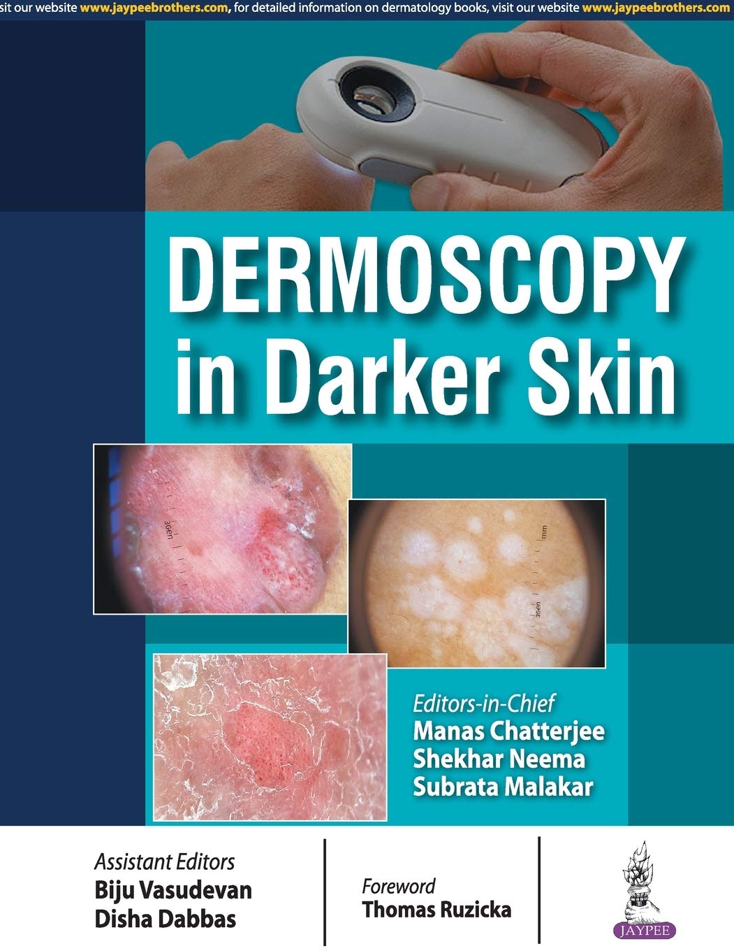 Dermoscopy In Darker Skin