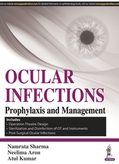 Ocular Infections Prophylaxis And Management