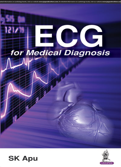 Ecg For Medical Diagnosis