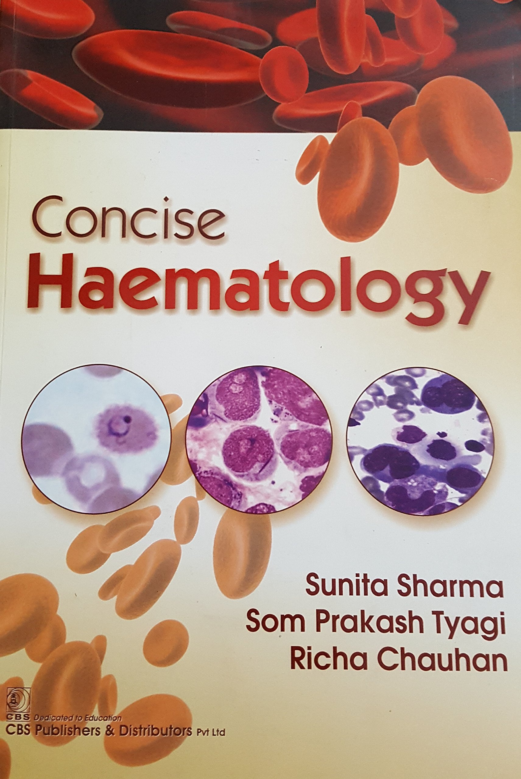 Concise Haematology (Pb)