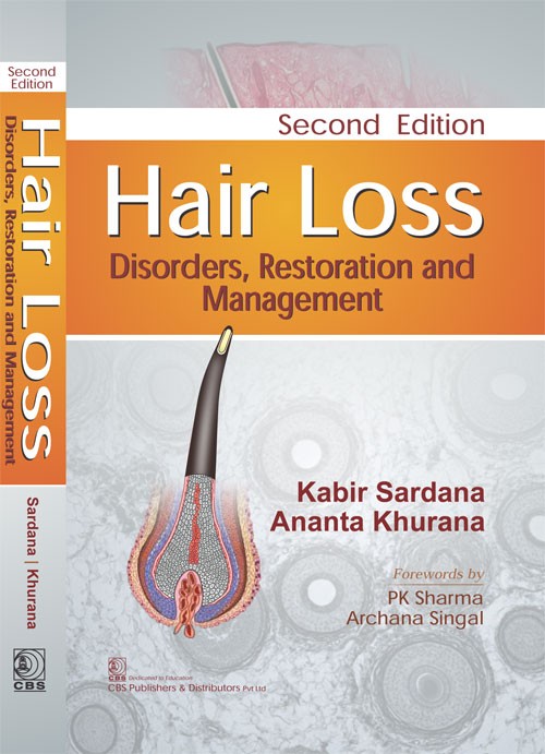 Hair Loss Disorders Restoration And Management 2Ed (Hb 2018)