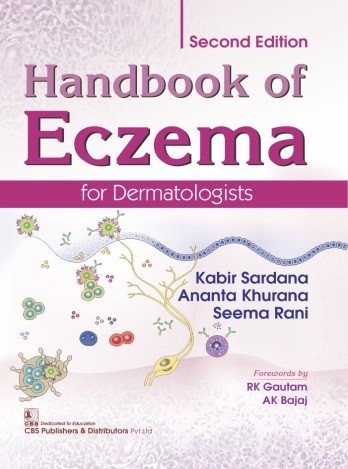 Handbook Of Eczema For Dermatologists 2Ed (Hb 2019)